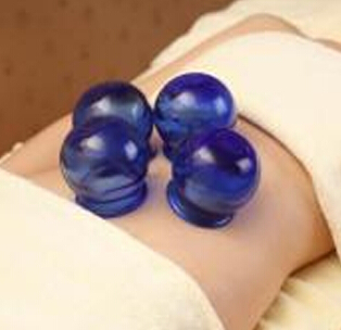 Pull out cupping to lose weight