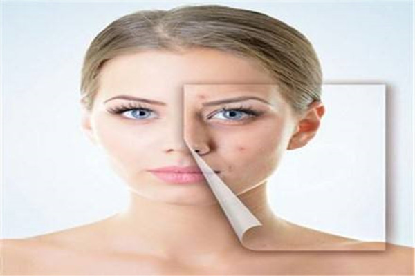 肌肤问题 肌肤问题