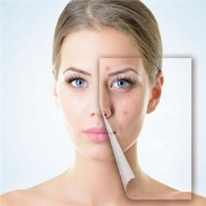 科痘祛痘店面效果图