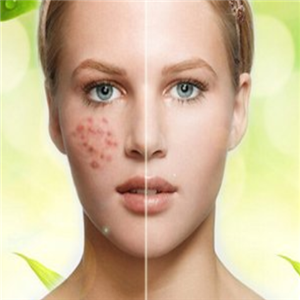 科痘祛痘加盟实例图片