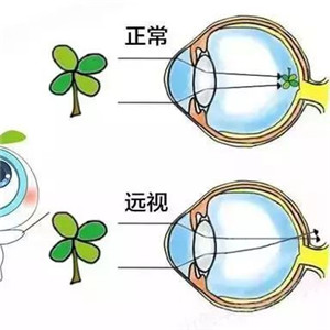 两只眼睛视力防治中心加盟图片