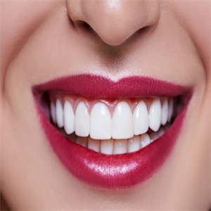  Xingyao International Teeth Beauty