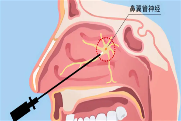 荟奥鼻炎馆加盟