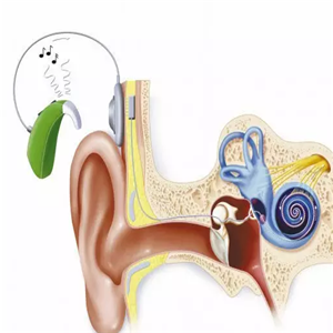  Xijia Hearing Aid is invited to join us
