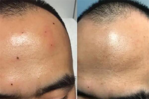 纯中药淡斑加盟