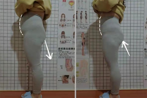 修蔻徒手产后骨态重塑加盟