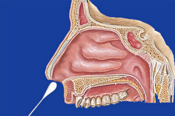 李麻子鼻炎馆加盟